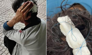 Xác minh vụ nam shipper ở Bình Dương bị chém khi đi giao hàng 