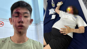 Công an vào cuộc vụ 'người phụ nữ mang bầu 8 tháng bị hành hung ở Đồng Nai'