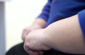 Tăng 60kg trong 2 năm sau biến cố hôn nhân