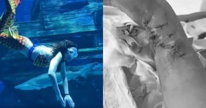 ‘Nàng tiên cá’ bị cá mập cắn tàn phế trong thủy cung