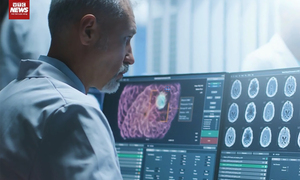  AI chẩn đoán bệnh Alzheimer qua điện thoại sắp thành hiện thực
