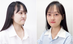 Cô gái 'lột xác' sau hai cuộc đại phẫu kỳ diệu