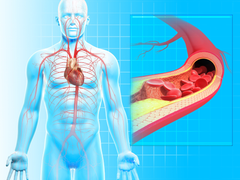 Mạch máu càng trẻ, càng sống lâu: Bác sĩ chỉ cách kiểm tra và làm sạch mạch máu