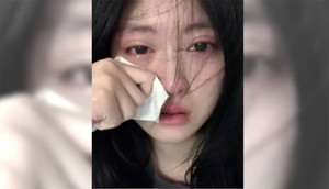 Đăng ảnh khóc quá đẹp, cô gái 19 tuổi bị các web khiêu dâm trộm ảnh để quảng cáo