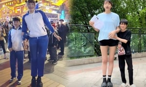 Bất chấp phản đối, cô gái 2,2m quyết sinh con cho 'chàng lùn' 1,68m