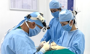 Mặt biến dạng sau nâng mũi bằng chỉ 
