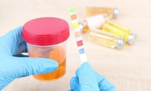 Dấu hiệu của ung thư thận dễ bị bỏ qua