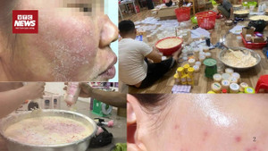 Sự thật ghê người đằng sau những hũ kem ‘trắng hồng siêu tốc’