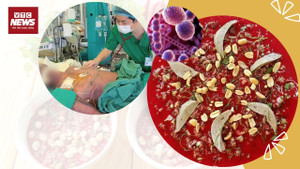 Ăn tiết canh để 'giải đen', nhiều người nhập viện