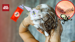 Gội đầu hay đầu độc: Sự thật rùng mình từ phòng tắm của nhiều gia đình