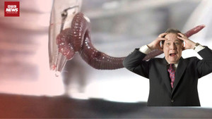 Rùng mình: Uống nước suối, vắt 8cm chui vào mũi hút máu từng giờ không hay biết 