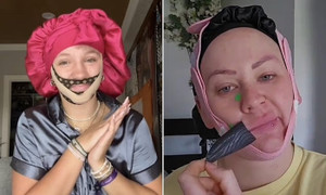 Chuyên gia báo nguy về kiểu làm đẹp cực đoan, hành xác của gen Z