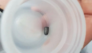 Người phụ nữ bất ngờ trúng đạn khi đang làm vườn