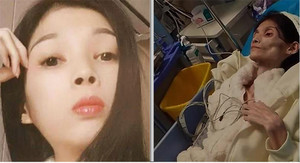 Số phận bi thảm của cô gái xinh đẹp biến thành 'bộ xương di động' 17kg