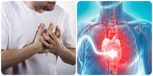 Biểu hiện truỵ tim mạch bạn không nên chủ quan