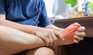 Hai dấu hiệu điển hình của bệnh Chikungunia để phân biệt với sốt xuất huyết