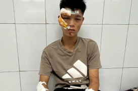 Lời khai của quái xế đi vào đường cấm phục vụ A80, tông cảnh sát cơ động