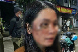 Điều tra vụ nữ shipper ở Đắk Lắk bị khách hành hung đến nhập viện