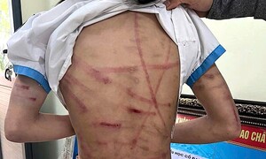 Bé gái lớp 5 ở Hà Tĩnh bị cha dượng bạo hành dã man: Đây không phải lần đầu