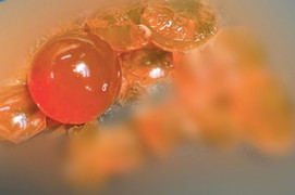 Bé trai 14 tháng tuổi phải nhập viện vì nuốt hạt nở đồ chơi