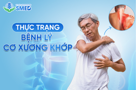 SMED – Hệ thống chăm sóc sức khỏe tiên phong trong điều trị cơ xương khớp
