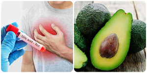 Cách ăn uống để giảm axit uric hiệu quả nhất