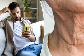 Những người trẻ da nhăn nheo, cổ chảy xệ do suốt ngày cắm mặt vào điện thoại