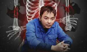 Cựu cán bộ y tế cầm đầu đường dây tự đánh vỡ xương trục lợi 6 tỷ đồng bảo hiểm