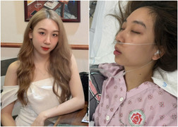 Cơn đau đầu bất thường kéo cô gái 28 tuổi vào biến cố đột quỵ