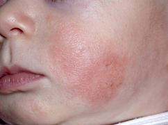 Cấp đủ ẩm cho da bé - bí quyết phòng ngừa các vấn đề về da mùa thu đông