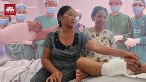 Nối thành công bàn tay 'sống' ở chân thai phụ: 65 ngày làm nên kỳ tích y học