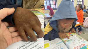 Hình ảnh bàn tay nứt nẻ của cậu bé 8 tuổi vùng cao khiến triệu người nghẹn lại