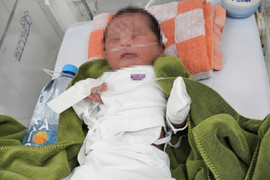 Điều tra vụ bé gái sơ sinh bị vùi lấp trong vườn cao su tại Gia Lai