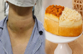 5 thực phẩm người có u tuyến giáp không nên ăn dù thèm đến mấy