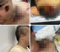 Ám ảnh trận đòn 'nhập môn' tại Trung tâm Công tác xã hội Hải Hà