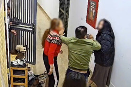 Kết quả giám định thương tích người phụ nữ bị hàng xóm hành hung tại chung cư