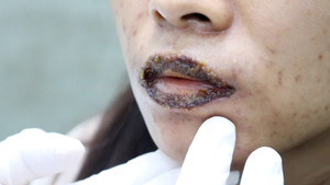 Làm đẹp cấp tốc, nhiều người 'tiền mất tật mang'