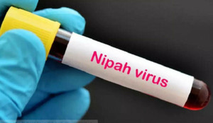 Virus Nipah lây qua đường nào?