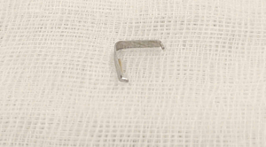 Tưởng con mọc răng, mẹ tá hỏa phát hiện vật sắc nhọn găm trong họng