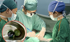 Bé gái 18 tháng tuổi nguy kịch, ruột tắc nghẽn vì nuốt hạt nở đồ chơi