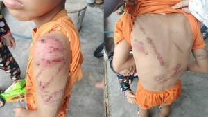 Xác minh vụ bé trai 10 tuổi ở Đắk Lắk nghi bị bố ruột bạo hành