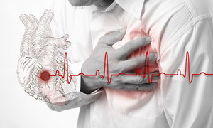 Đột quỵ dễ nhầm cơn say ngày Tết, bác sĩ chỉ dấu hiệu 'then chốt' giúp phân biệt