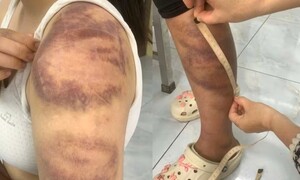 Tạm giữ gã chồng 4 lần đánh đập vợ bầu và con gái 13 tuổi