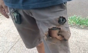 Điện thoại phát nổ cứu sống một người khỏi nanh vuốt chó dữ