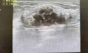 Phát hiện ung thư khi đi khám sức khoẻ định kỳ