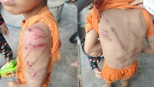 Đánh con trai 10 tuổi bầm tím cơ thể, người đàn ông ở Đắk Lắk bị phạt