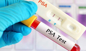 3 ca ung thư tuyến tiền liệt trong 1 ngày, bác sĩ chỉ lý do bệnh dễ bị bỏ sót