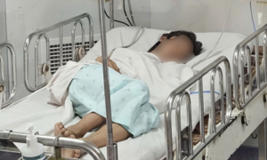 Cứu bé gái nhiễm não mô cầu nguy kịch sau khi tiếp xúc ca tử vong