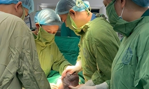  Em bé mang 'đôi cánh tí hon' chào đời diệu kỳ sau ca can thiệp từ bụng mẹ