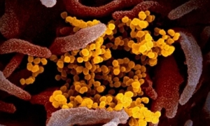 Biến thể COVID-19 'Ve sầu' né vaccine, lây nhanh tại Mỹ: Bộ Y tế cảnh báo gì?